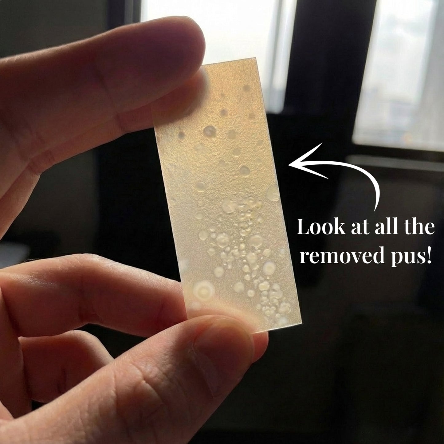 HerCharm Skin Healing Roll