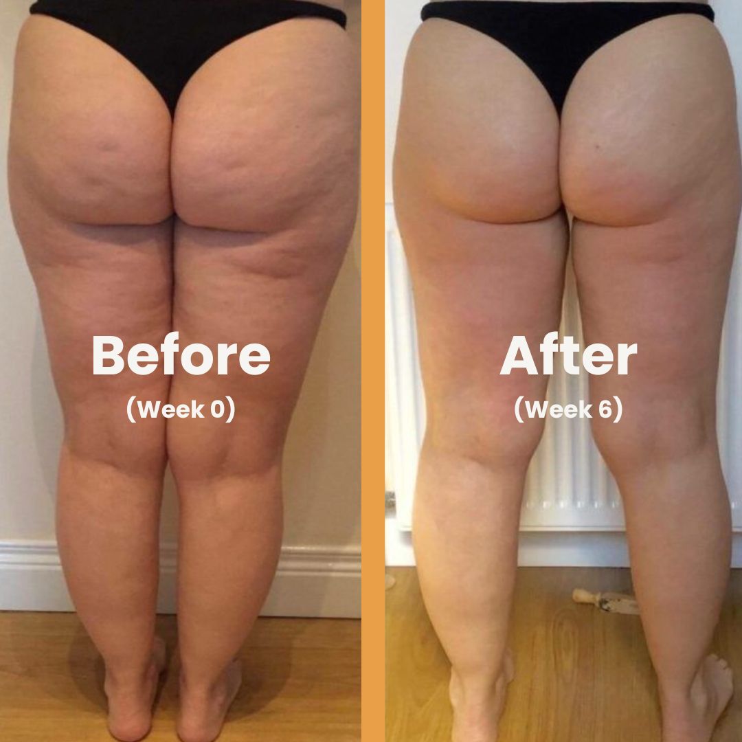 HerCharm™ Anti-Cellulite Oil
